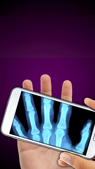 X����ģ�������°�