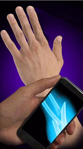 X����ģ�������°�