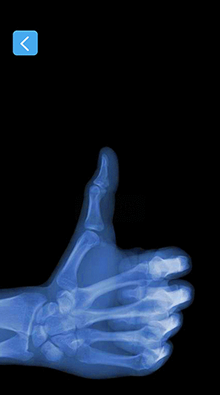 X����ģ�������°�