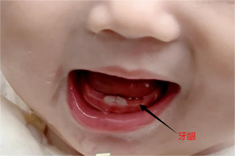 �����ڱ�������ˮ��������֢״ͼ