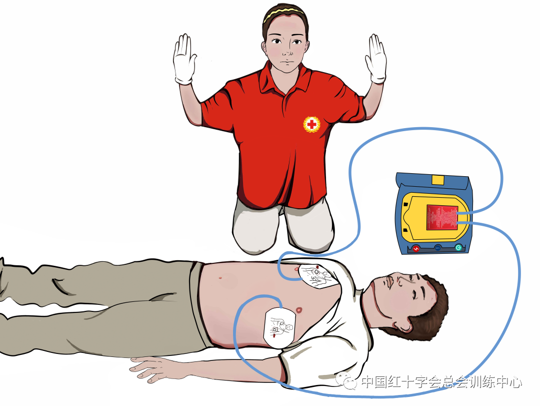 My AED 分析心律 放电按键 操作界面特写