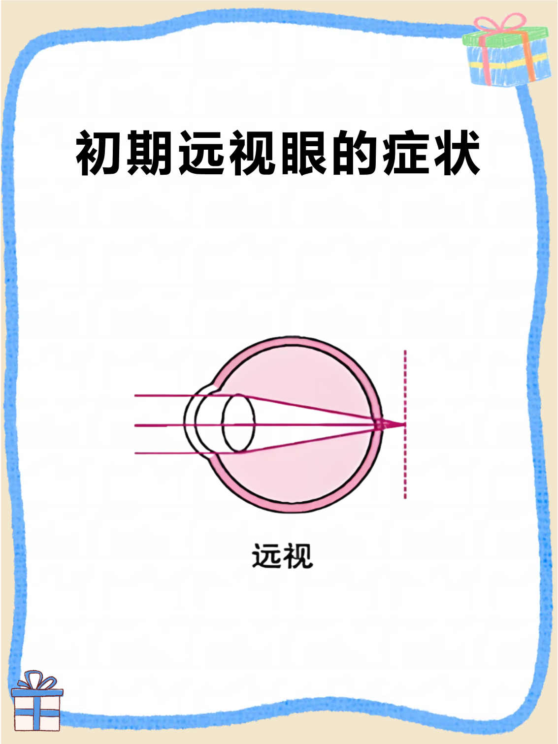驰云远视 症状表现 眼科检查 图解
