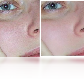 CleanSkinFX ��׿�� ����