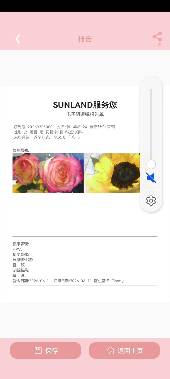SunlandScope20260901_V2.26 ��������