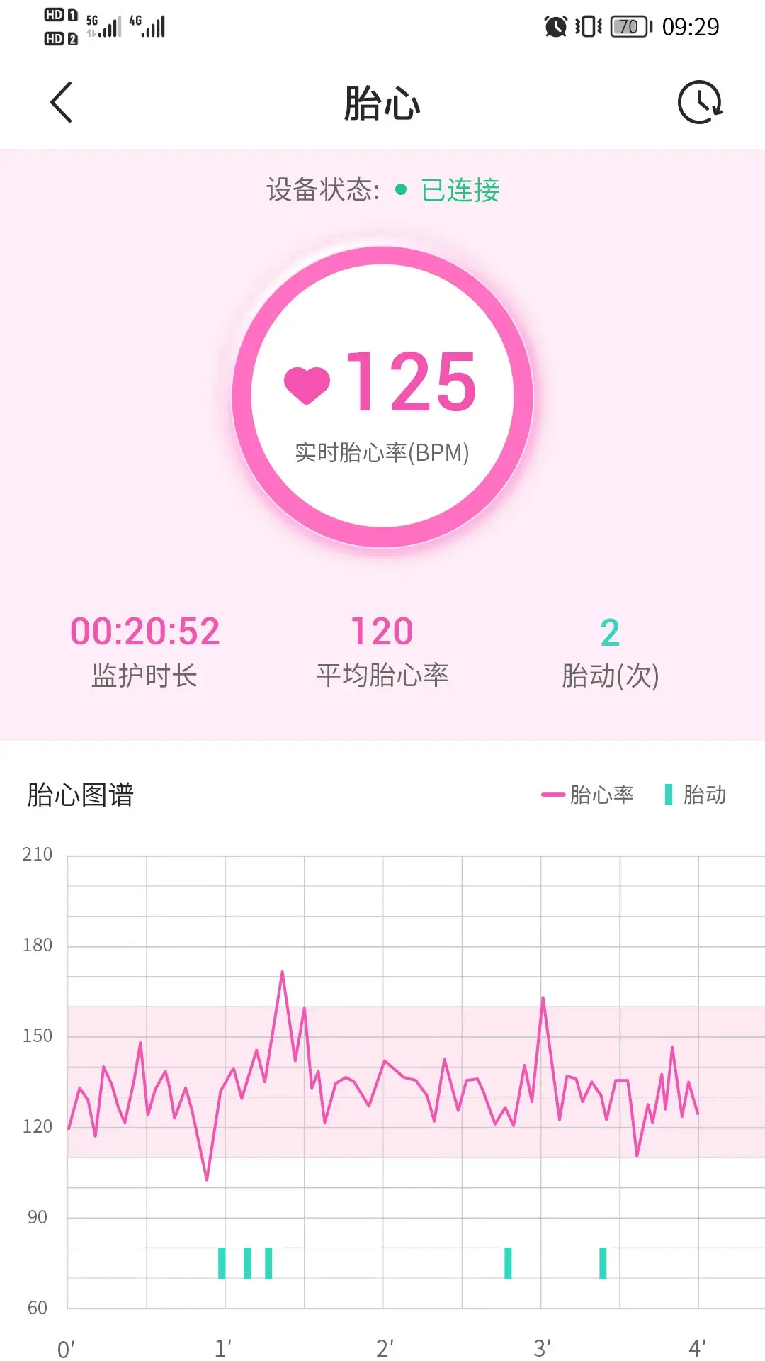 �Թ����и�1.3.40 ����̥�ļ໤